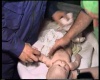 Дарья Ягудина после спасения, 3 мес