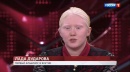 Лада Дударова - первая девушка альбинос из Якутии
